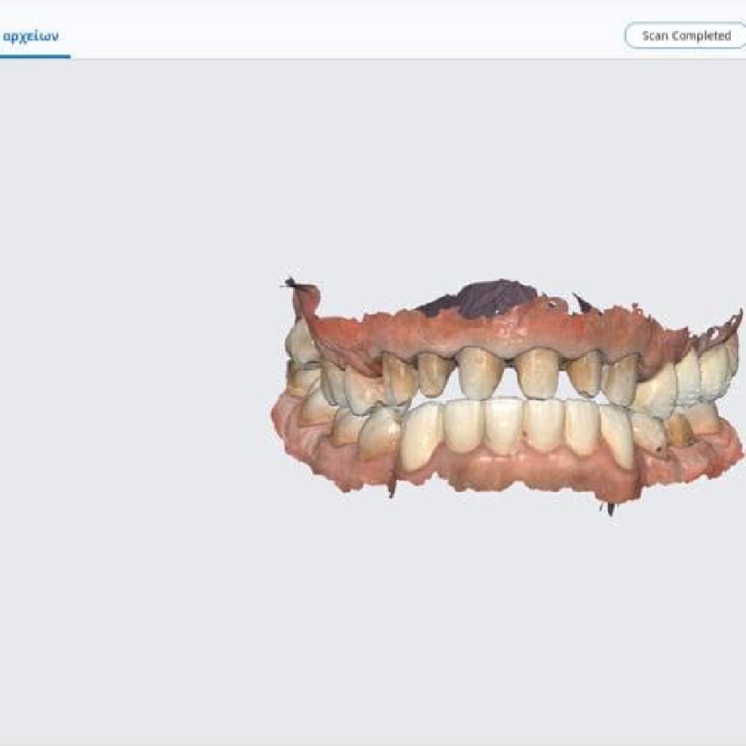 Ολοκληρωμένο ψηφιακό intraoral scan γνάθων – Digital Workflow Stratos Lab