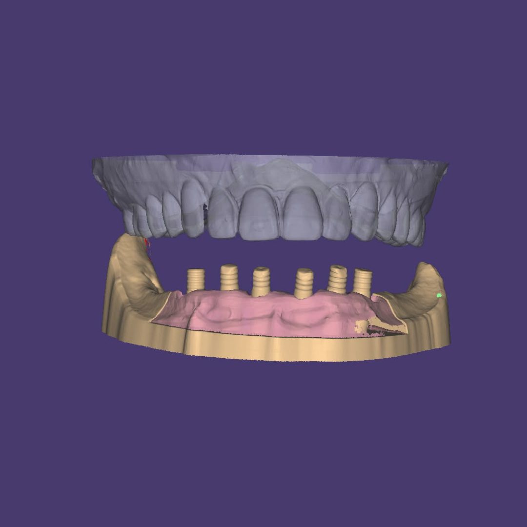 ergasies-digital-workflow-stratos-lab-12